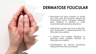 DERMATOSE FOLICULAR
• Dermatose por óleos minerais ou fluídos
de cortes que são produtos líquidos de
composição pouco complexa utilizados
para lubrificar e eliminar o calor
ocasionado pelo processo produtivo;
• Apresentam quadro de acne e foliculite,
que favorecem o desenvolvimento de
infecções secundárias;
• A limpeza com sabões abrasivos ou
solventes fortes também facilitam as
infecções secundárias;
• Trabalhadores de oficinas mecânicas
frequentemente são acometidos.
 