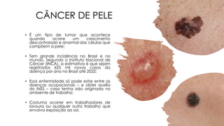 CÂNCER DE PELE
• É um tipo de tumor que acontece
quando ocorre um crescimento
descontrolado e anormal das células que
compõem a pele;
• Tem grande incidência no Brasil e no
mundo. Segundo o Instituto Nacional de
Câncer (INCA), a estimativa é que sejam
registrados 625 mil novos casos da
doença por ano no Brasil até 2022;
• Essa enfermidade só pode estar entre as
doenças ocupacionais – e obter auxílio
do INSS – caso tenha sido originada no
ambiente de trabalho;
• Costuma ocorrer em trabalhadores de
lavoura ou qualquer outro trabalho que
envolva exposição ao sol.
 