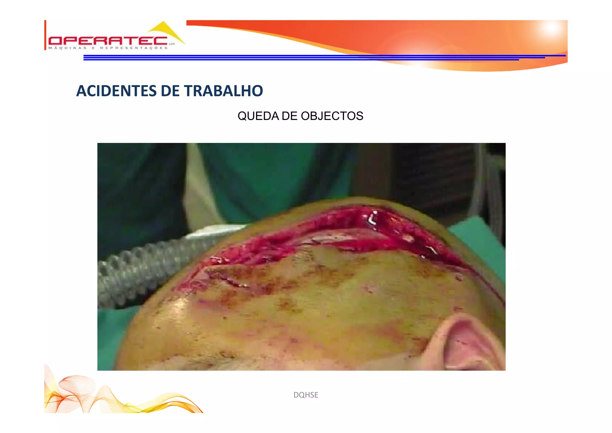 DQHSE
ACIDENTES DE TRABALHO
QUEDA DE OBJECTOS
 