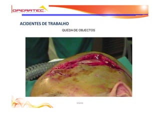 DQHSE
ACIDENTES DE TRABALHO
QUEDA DE OBJECTOS
 