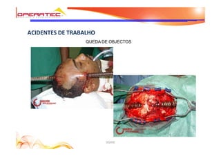 DQHSE
ACIDENTES DE TRABALHO
QUEDA DE OBJECTOS
 