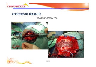 DQHSE
ACIDENTES DE TRABALHO
QUEDA DE OBJECTOS
 
