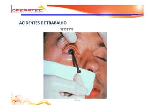 DQHSE
ACIDENTES DE TRABALHO
????????
 