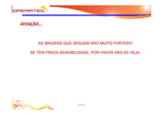 DQHSE
ATENÇÃO…
AS IMAGENS QUE SEGUEM SÃO MUITO FORTES!!!
SE TEM FRACA SENSIBILIDADE, POR FAVOR NÃO AS VEJA.
 