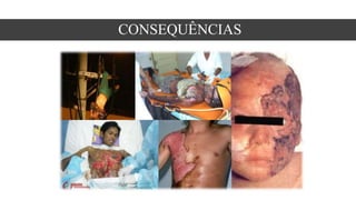 CONSEQUÊNCIAS
 