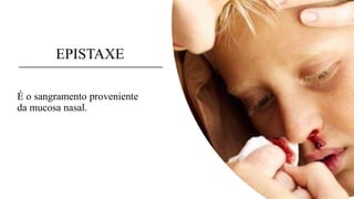 EPISTAXE
É o sangramento proveniente
da mucosa nasal.
 