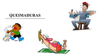 QUEIMADURAS
 