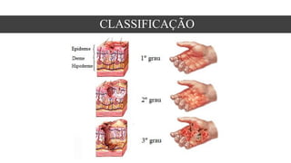 CLASSIFICAÇÃO
 