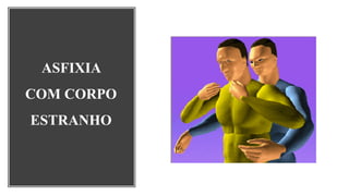 ASFIXIA
COM CORPO
ESTRANHO
 