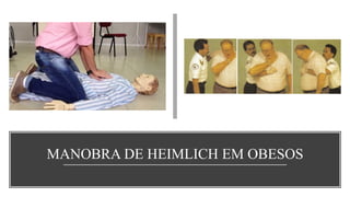 MANOBRA DE HEIMLICH EM OBESOS
 