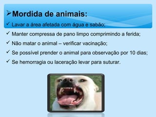 Mordida de animais:
 Lavar a área afetada com água e sabão;
 Manter compressa de pano limpo comprimindo a ferida;
 Não matar o animal – verificar vacinação;
 Se possível prender o animal para observação por 10 dias;
 Se hemorragia ou laceração levar para suturar.
 
