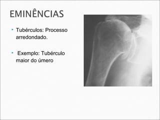 Tubérculos: Processo
arredondado.
 Exemplo: Tubérculo
maior do úmero
 