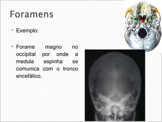  Exemplo:
 Forame magno no
occipital por onde a
medula espinha se
comunica com o tronco
encefálico.
 
