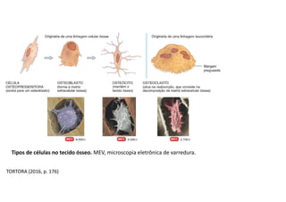Tipos de células no tecido ósseo. MEV, microscopia eletrônica de varredura.
TORTORA (2016, p. 176)
 