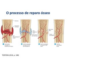 O processo de reparo ósseo
TORTORA (2016, p. 188)
 