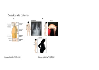 Desvios de coluna
https://bit.ly/33fxEvU https://bit.ly/33fT0JC
 