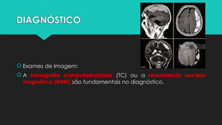 DIAGNÓSTICO
 Exames de Imagem:
 A tomografia computadorizada (TC) ou a ressonância nuclear
magnética (RNM) são fundamentais no diagnóstico.
 
