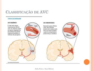 CLASSIFICAÇÃO DE AVC




             Sofia Pinto e Sara Ribeiro
 