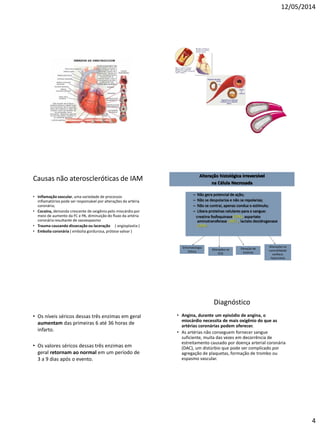12/05/2014
4
Causas não ateroscleróticas de IAM
• Inflamação vascular, uma variedade de processos
inflamatórios pode ser responsável por alterações da artéria
coronária;
• Cocaína, demanda crescente de oxigênio pelo miocárdio por
meio de aumento da FC e PA, diminuição do fluxo da artéria
coronária resultante de vasoespasmo
• Trauma causando dissecação ou laceração ( angioplastia )
• Embolia coronária ( embolia gordurosa, prótese valvar )
– Não gera potencial de ação;
– Não se despolariza e não se repolariza;
– Não se contrai, apenas conduz o estímulo;
– Libera proteínas celulares para o sangue:
creatina fosfoquinase (CPK), aspartato
aminotransferase ( AST ), lactato desidrogenase
(LDH).
Alteração histológica irreversível
na Célula Necrosada
Sintomatologia
Clínica
Alterações no
ECG
Elevação de
enzimas
Alterações na
contratilidade
cardíaca:
hipocinesia
• Os níveis séricos dessas três enzimas em geral
aumentam das primeiras 6 até 36 horas de
infarto.
• Os valores séricos dessas três enzimas em
geral retornam ao normal em um período de
3 a 9 dias após o evento.
Diagnóstico
• Angina, durante um episódio de angina, o
miocárdio necessita de mais oxigênio do que as
artérias coronárias podem oferecer.
• As artérias não conseguem fornecer sangue
suficiente, muita das vezes em decorrência de
estreitamento causado por doença arterial coronária
(DAC), um distúrbio que pode ser complicado por
agregação de plaquetas, formação de trombo ou
espasmo vascular.
 