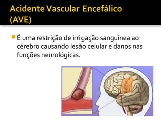 É uma restrição de irrigação sanguínea ao 
cérebro causando lesão celular e danos nas 
funções neurológicas. 
 