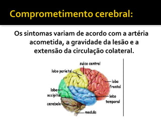 Os sintomas variam de acordo com a artéria 
acometida, a gravidade da lesão e a 
extensão da circulação colateral. 
 
