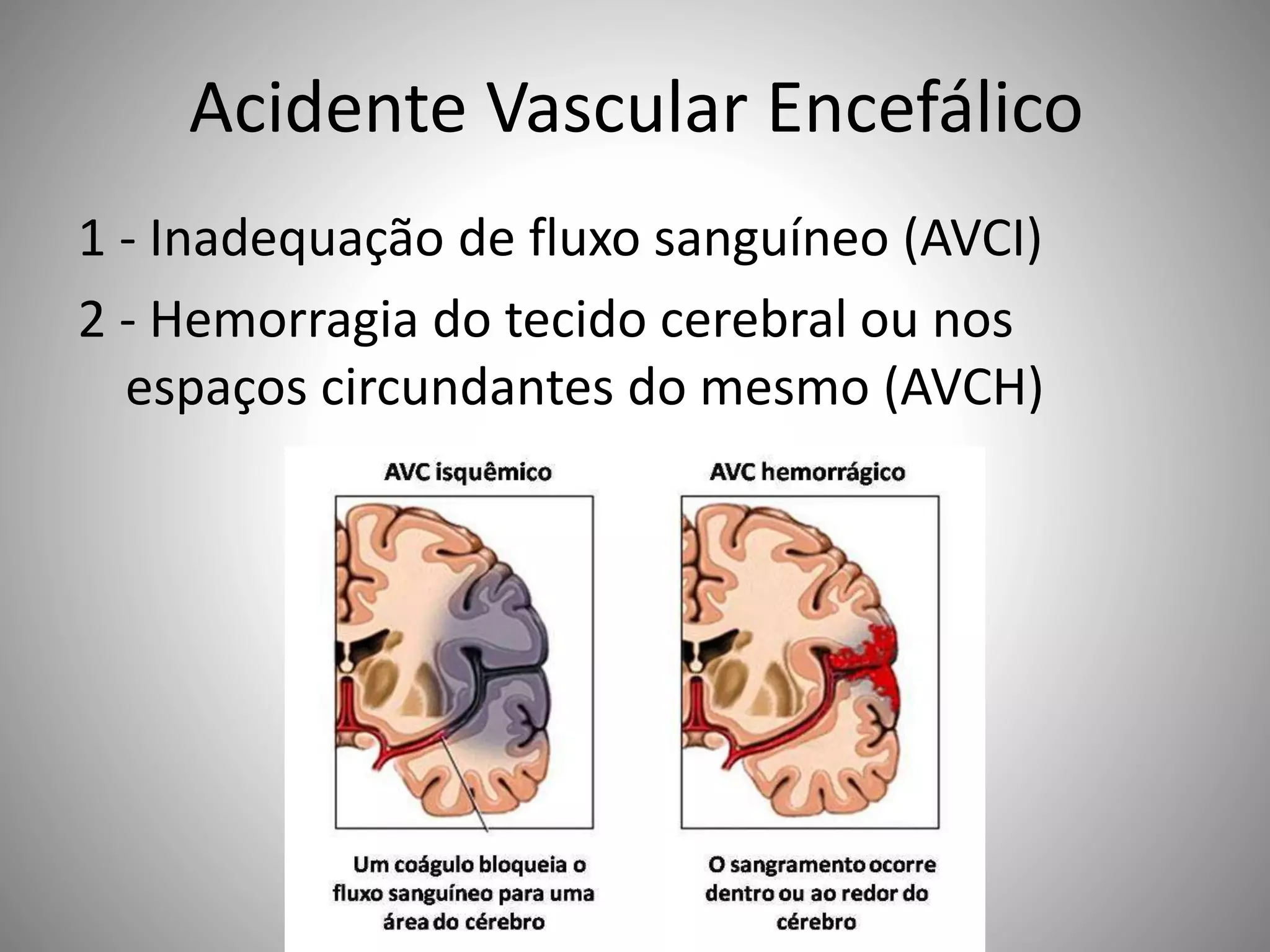 Acidente Vascular Encefálico | PPTX