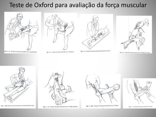 Teste de Oxford para avaliação da força muscular
 