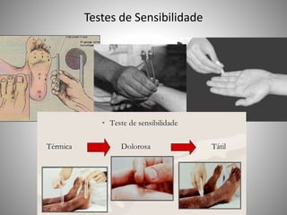 Testes de Sensibilidade
 