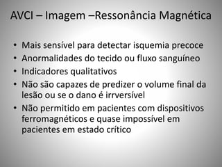AVCI – Imagem –Ressonância Magnética
• Mais sensível para detectar isquemia precoce
• Anormalidades do tecido ou fluxo sanguíneo
• Indicadores qualitativos
• Não são capazes de predizer o volume final da
lesão ou se o dano é irrversível
• Não permitido em pacientes com dispositivos
ferromagnéticos e quase impossível em
pacientes em estado crítico
 