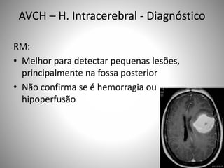 AVCH – H. Intracerebral - Diagnóstico
RM:
• Melhor para detectar pequenas lesões,
principalmente na fossa posterior
• Não confirma se é hemorragia ou
hipoperfusão
 
