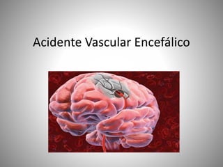 Acidente Vascular Encefálico
 