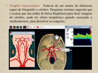 • Doppler transcraniano: Trata-se de um exame de ultrassom
capaz de fotografar o cérebro. Pesquisas recentes sugerem que
o exame que usa ondas de baixa freqüência para fazer imagens
do cérebro, pode ter efeito terapêutico quando associado a
medicamentos, para dissolver os coágulos.
 