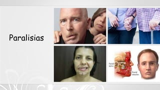 Paralisias
 