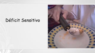 Déficit Sensitivo
 