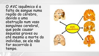 O AVC isquêmico é a
falta de sangue numa
região do cérebro,
devido a uma
obstrução num vaso
sanguíneo cerebral,
que pode causar
sequelas graves ou
até mesmo a morte do
indivíduo, se ele não
for socorrido à
tempo.
 