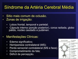 Síndrome da Artéria Cerebral Média
• Sítio mais comum de oclusão.
• Zonas de irrigação:

• Lobos frontal, temporal e parietal;
• Cápsula interna (porção posterior), coroa radiada, globo
pálido, núcleo caudado e putâmen.

• Manifestações Clínicas:

• Edema significativo;
• Hemiparesia contralateral (MS);
• Perda sensorial contralateral (MS e face);
• Comprometimento da fala;
• Déficit de percepção.
 