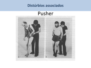 Distúrbios associados

     Pusher
 