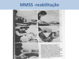 MMSS -reabilitação
 