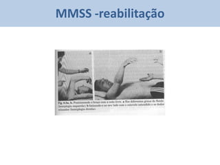 MMSS -reabilitação
 