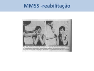 MMSS -reabilitação
 