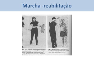 Marcha -reabilitação
 