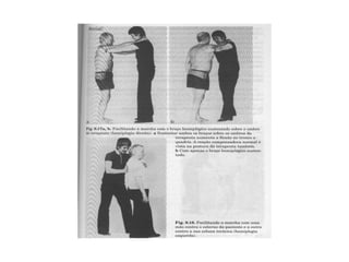 Acidente vascular encefálico parte2