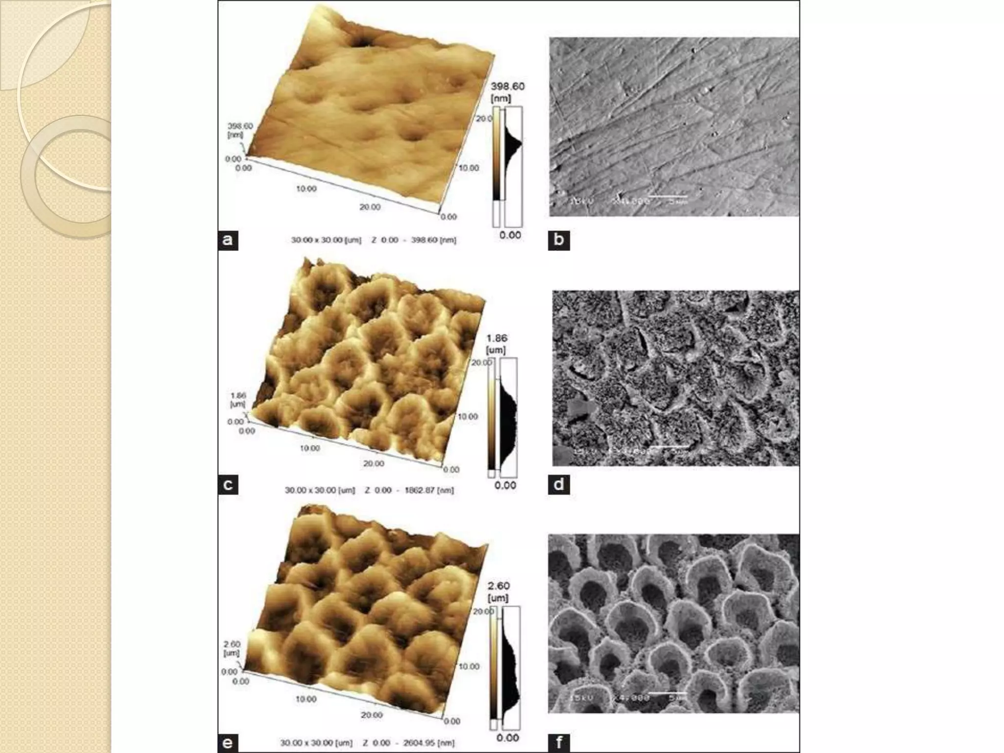 Acid Etching of Enamel and Bond Strength | PPTX