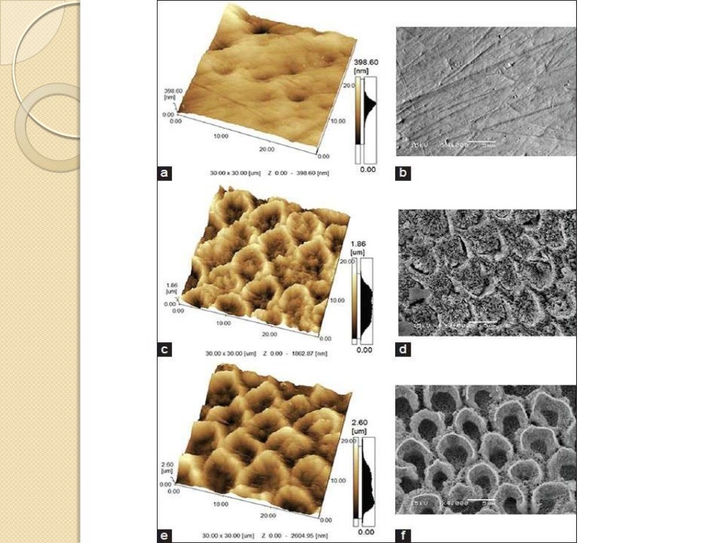 Acid Etching of Enamel and Bond Strength