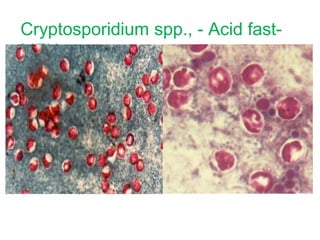 Cryptosporidium spp., - Acid fast-
MZN
 
