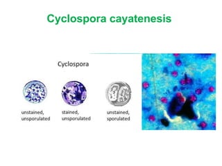 Cyclospora cayatenesis
 
