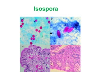 Isospora
 