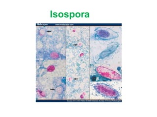 Isospora
 