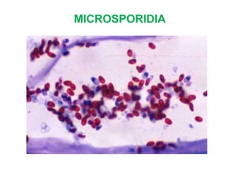 MICROSPORIDIA
 