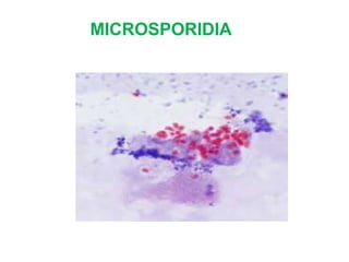 MICROSPORIDIA
 